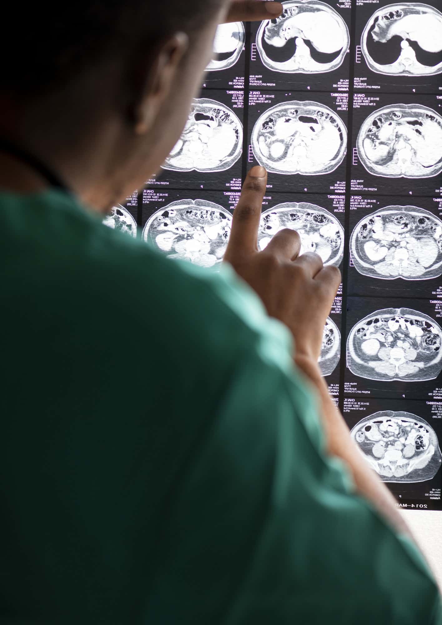 Doctor reading brain MRI x-ray result